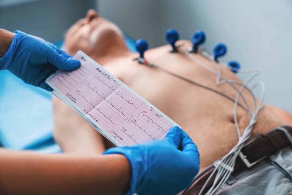 Certified Ekg Technician Ultimate Guide 2023 Duties Salary And More