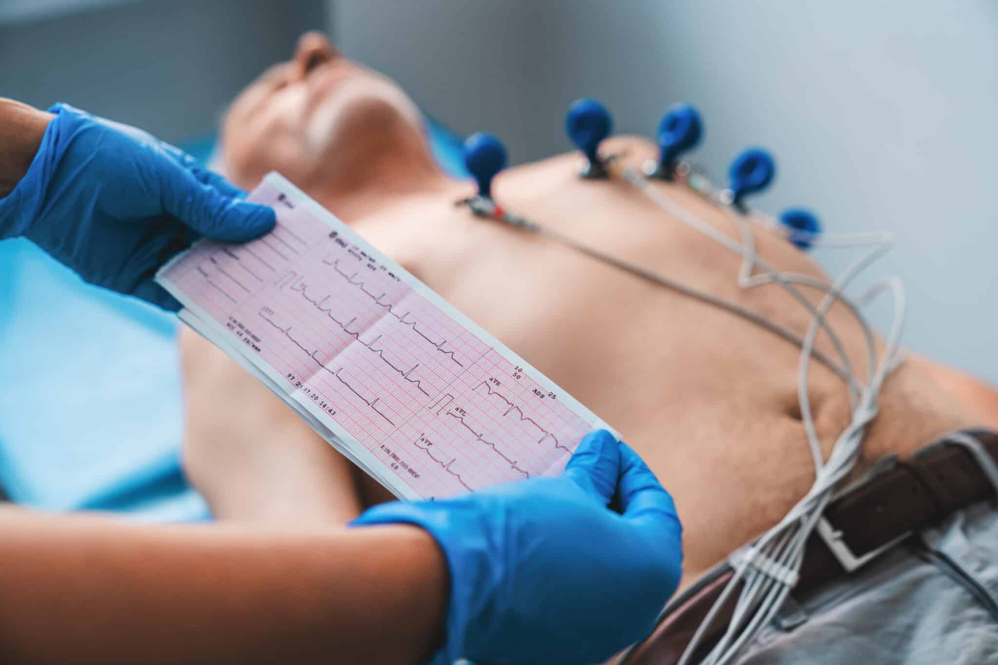 Certified EKG Technician | Ultimate Guide 2023 - Duties, Salary & More